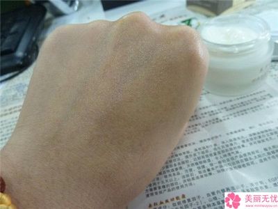 福州市凹陷疤痕激光手术的医院哪家机构好-凹陷疤痕激光手术价格究竟是多少